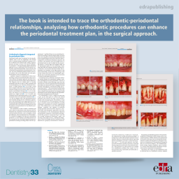 Orthodontics and Periodontology: Combined treatments and clinical synergies - Dentistry book - book extract - Roberto Kaitsas