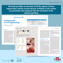 Bone regeneration in implantology: tooth as a graft - Dentistry book - book extract - Flavio Pisani - Elio Minetti