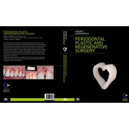Periodontal Plastic And Regenerative Surgery - cover book - Daniele Cardaropoli -  Dentistry book